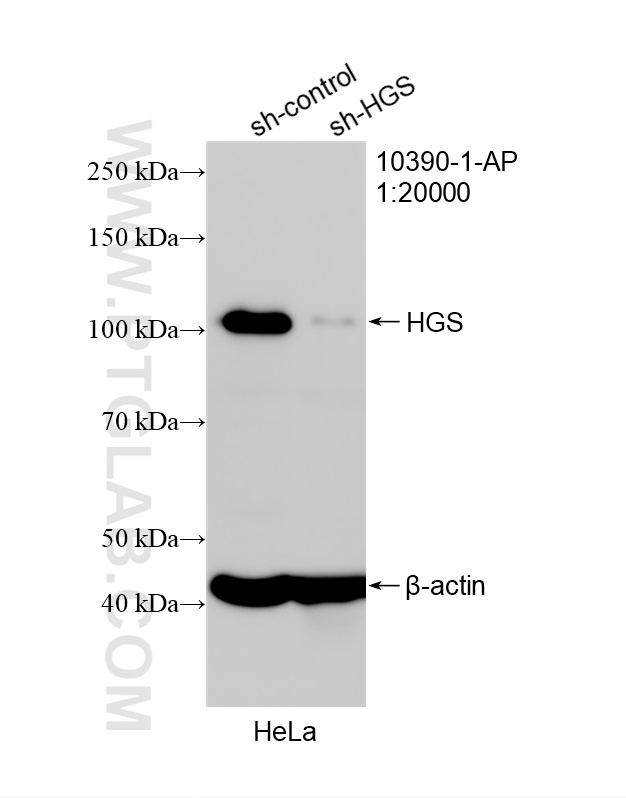 WB analysis of HeLa using 10390-1-AP