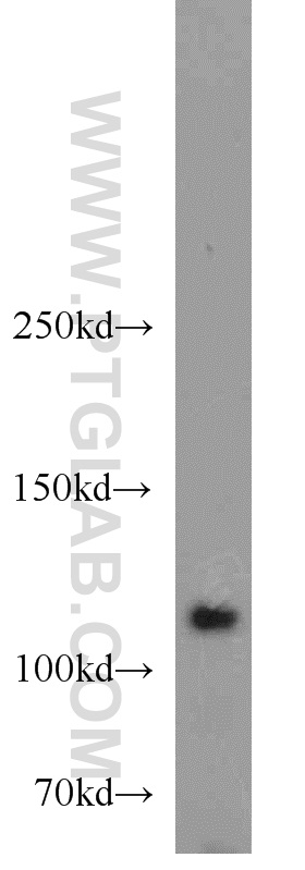 HGS Polyclonal antibody