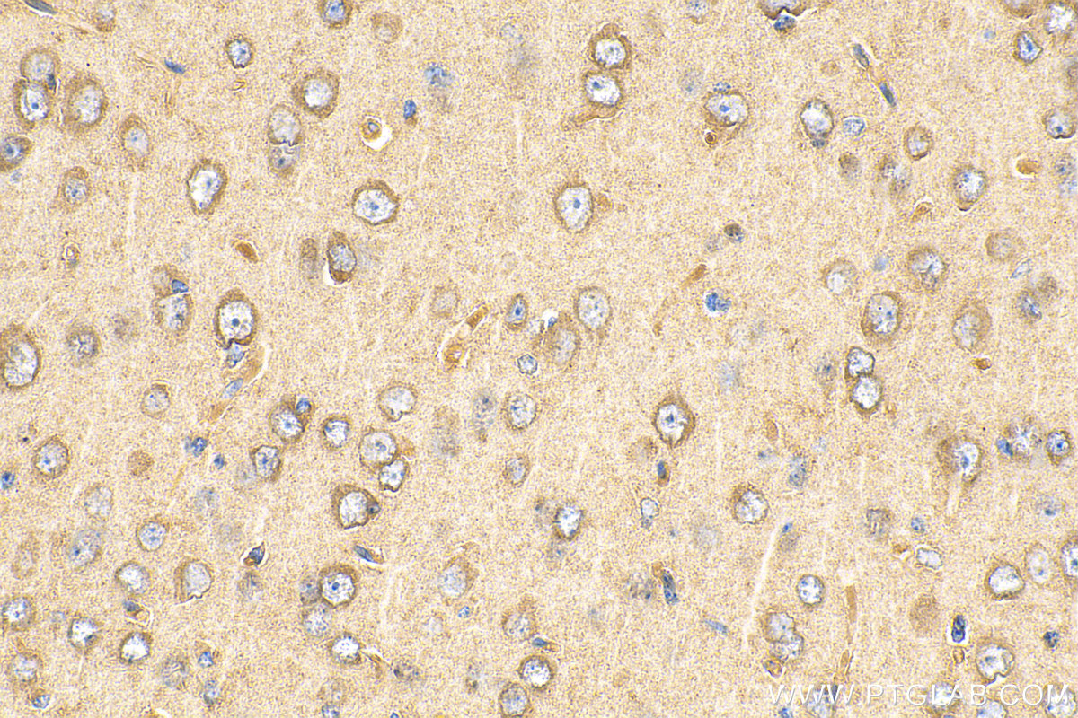 IHC staining of mouse brain using 67818-1-Ig