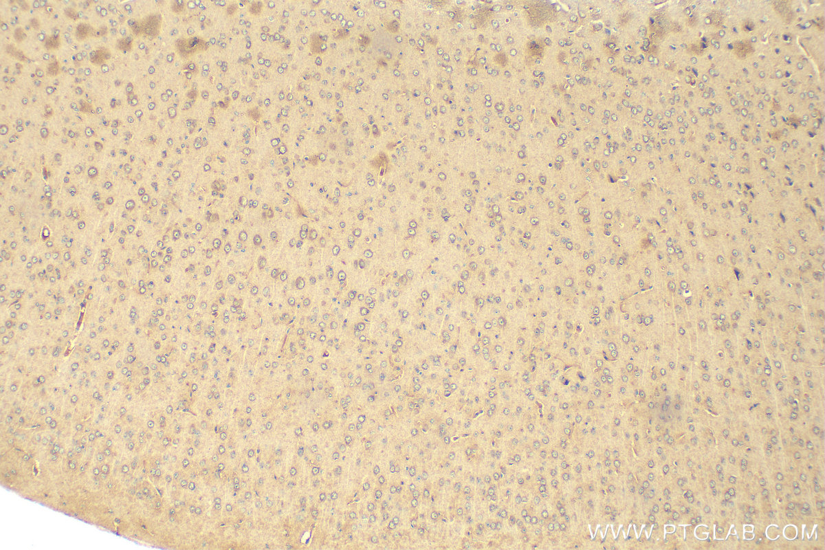 IHC staining of mouse brain using 67818-1-Ig