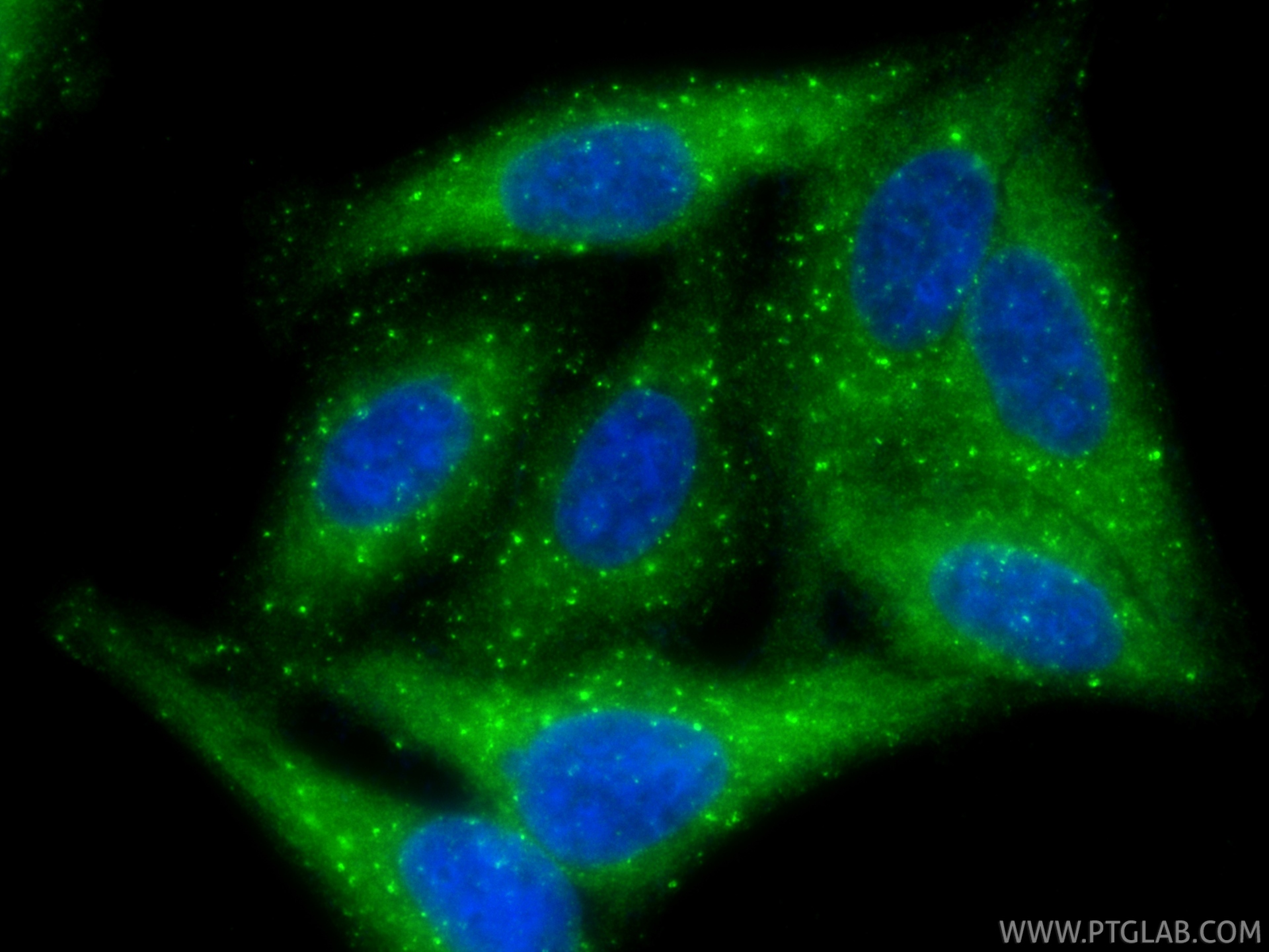 IF Staining of HepG2 using 87420-1-RR (same clone as 87420-1-PBS) IF Staining of HepG2 using 87420-1-RR (same clone as 87420-1-PBS)