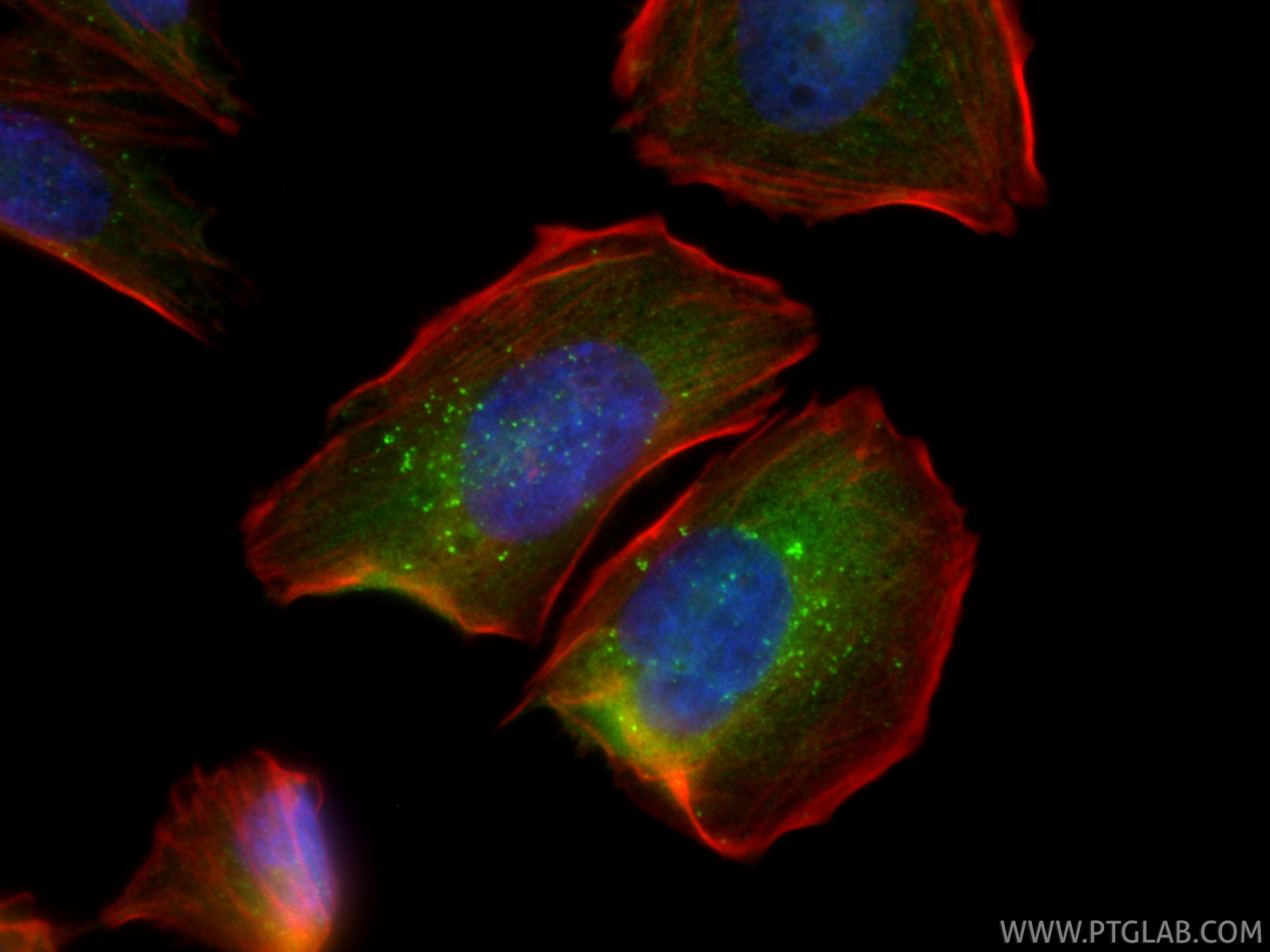 IF Staining of Saos-2 using 87420-1-RR (same clone as 87420-1-PBS) IF Staining of Saos-2 using 87420-1-RR (same clone as 87420-1-PBS)