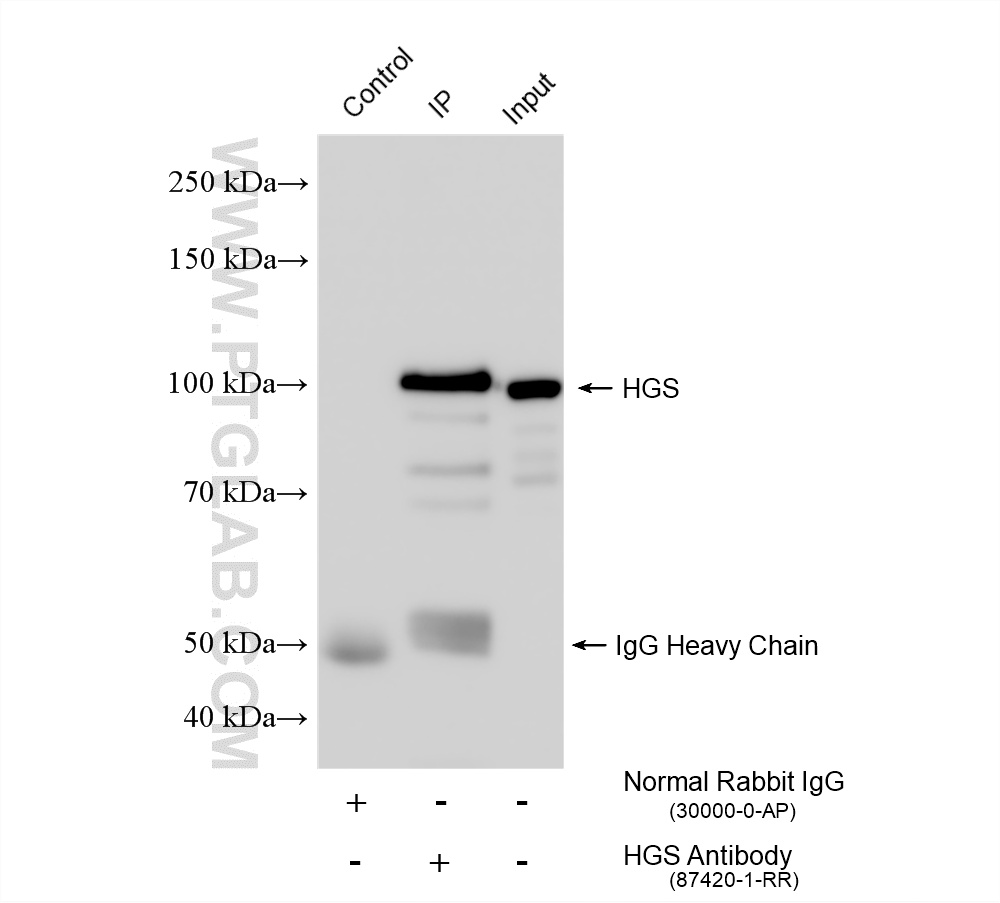 IP experiment of mouse brain using 87420-1-RR (same clone as 87420-1-PBS) IP experiment of mouse brain using 87420-1-RR (same clone as 87420-1-PBS)
