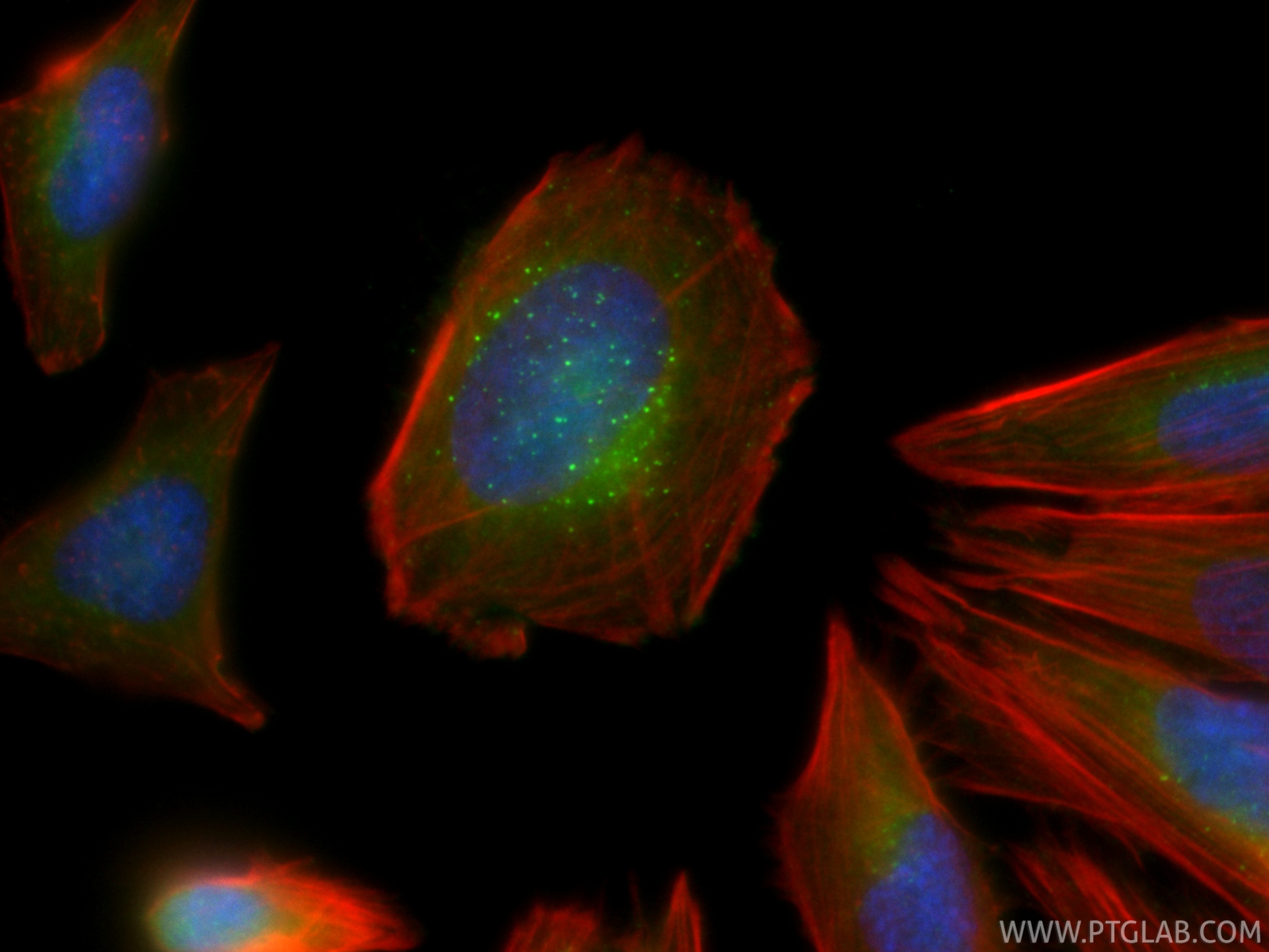 IF Staining of Saos-2 using CL488-87420 IF Staining of Saos-2 using CL488-87420