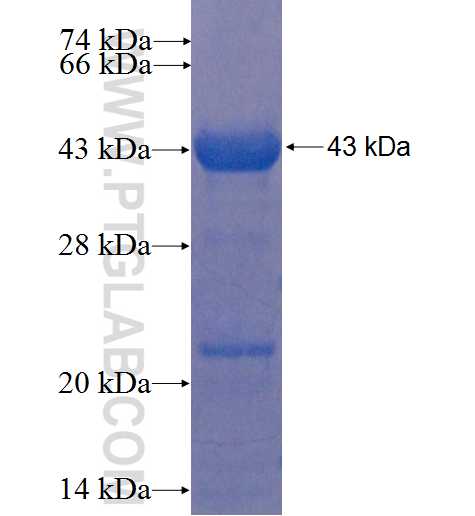 HGS fusion protein Ag22820 SDS-PAGE HGS fusion protein Ag22820 SDS-PAGE