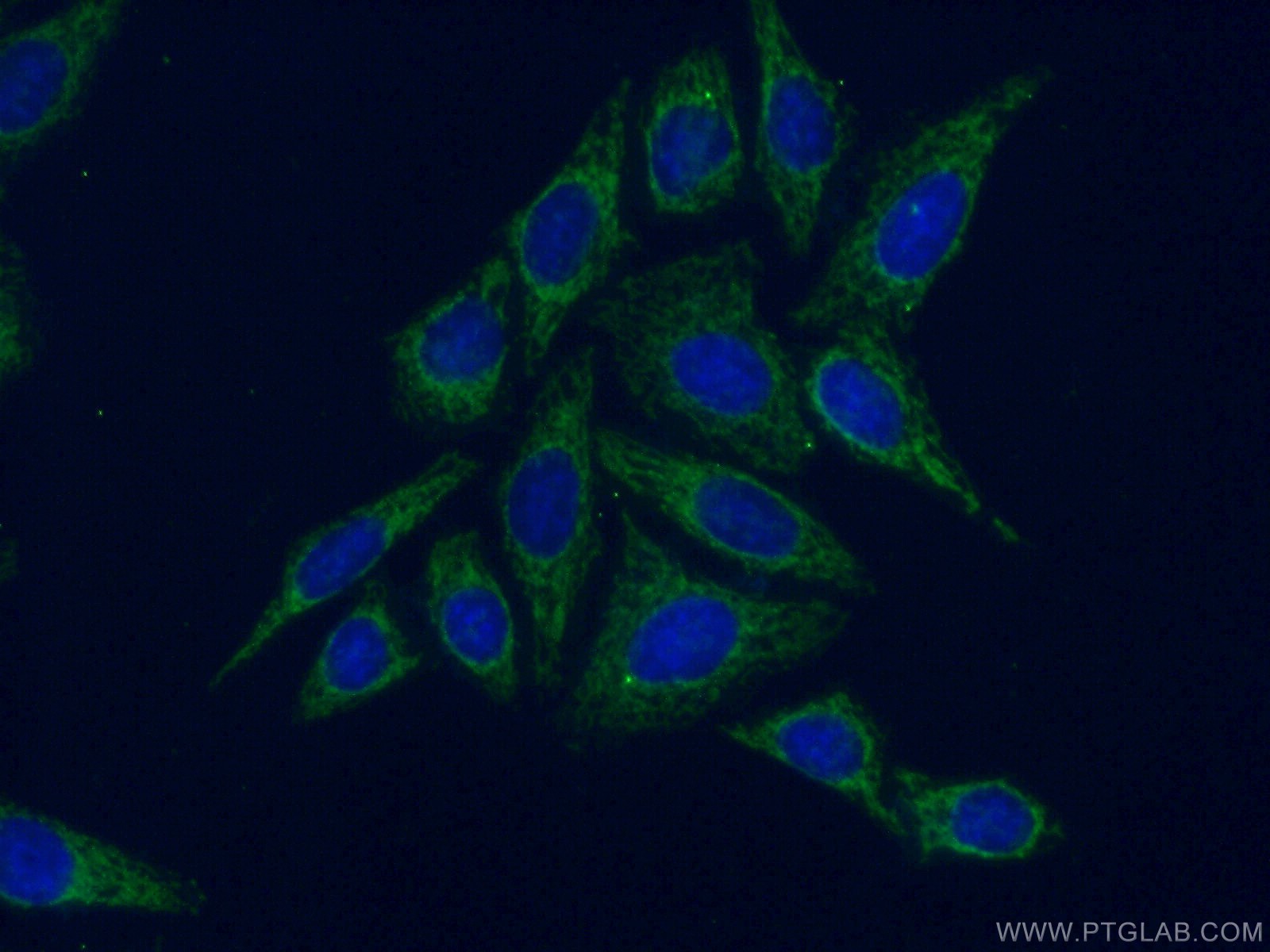 IF Staining of HepG2 using 12399-1-AP (same clone as 12399-1-PBS)