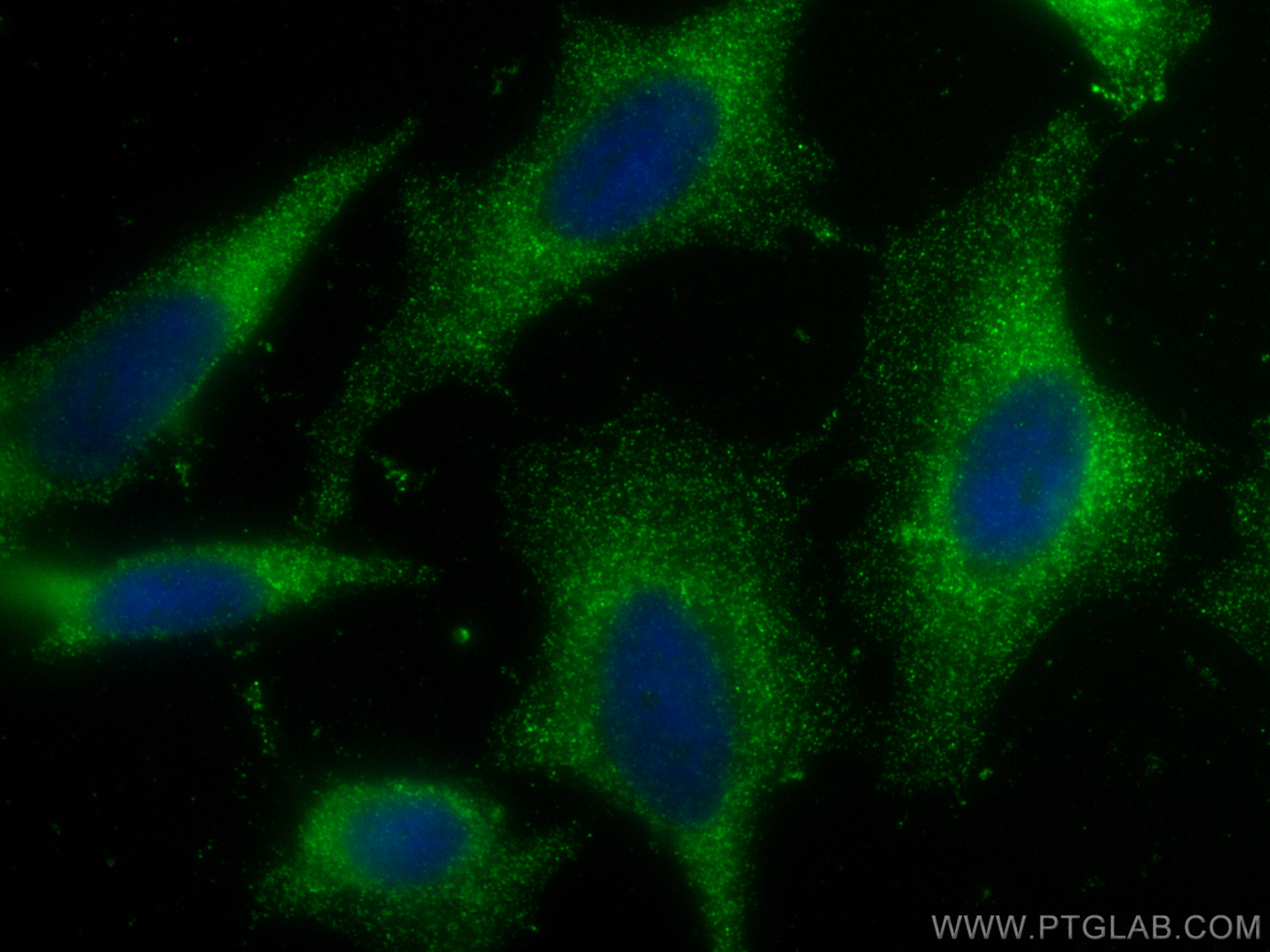 IF Staining of HeLa using 29466-1-AP