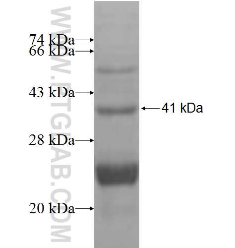HIATL1 fusion protein Ag9617 SDS-PAGE HIATL1 fusion protein Ag9617 SDS-PAGE