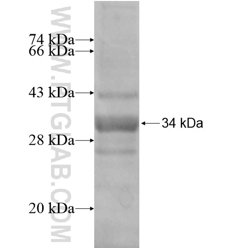 HIATL2 fusion protein Ag14570 SDS-PAGE HIATL2 fusion protein Ag14570 SDS-PAGE