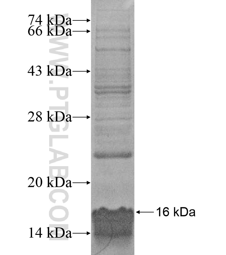 HIATL2 fusion protein Ag16958 SDS-PAGE HIATL2 fusion protein Ag16958 SDS-PAGE