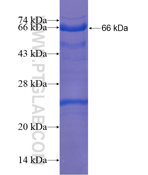 HIC1 fusion protein Ag21849 SDS-PAGE