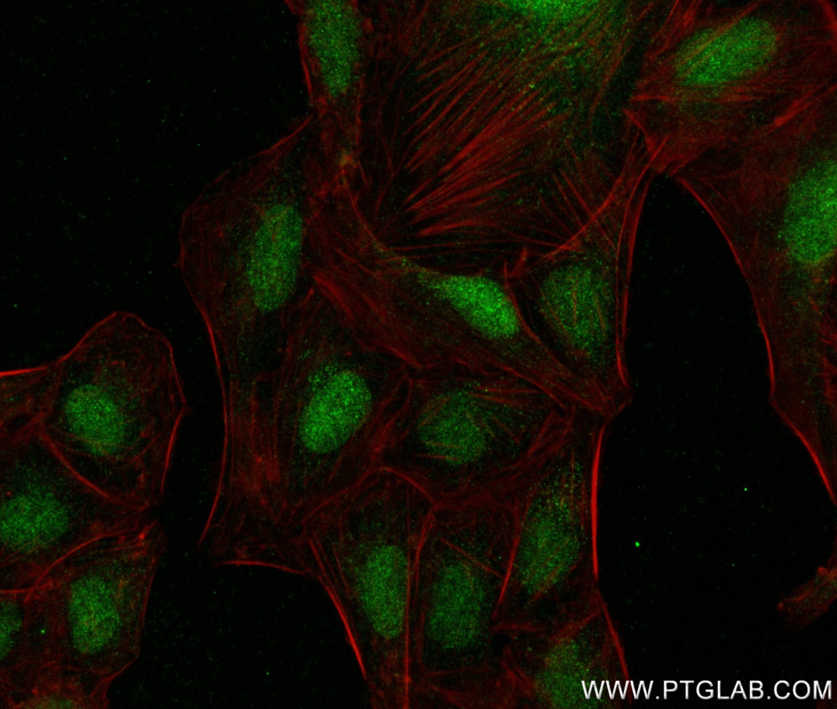 IF Staining of U2OS using 83162-7-RR