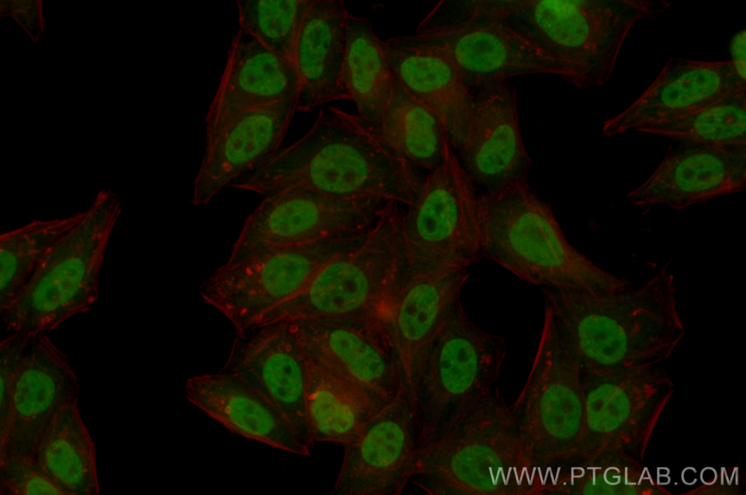 Immunofluorescent analysis of (4% PFA) fixed HepG2 cells using CoraLite® Plus 488 HIC2 antibody (CL488-83162-7, Clone: 230177E8 ) at dilution of 1:200. IF Staining of HepG2 using CL488-83162-7