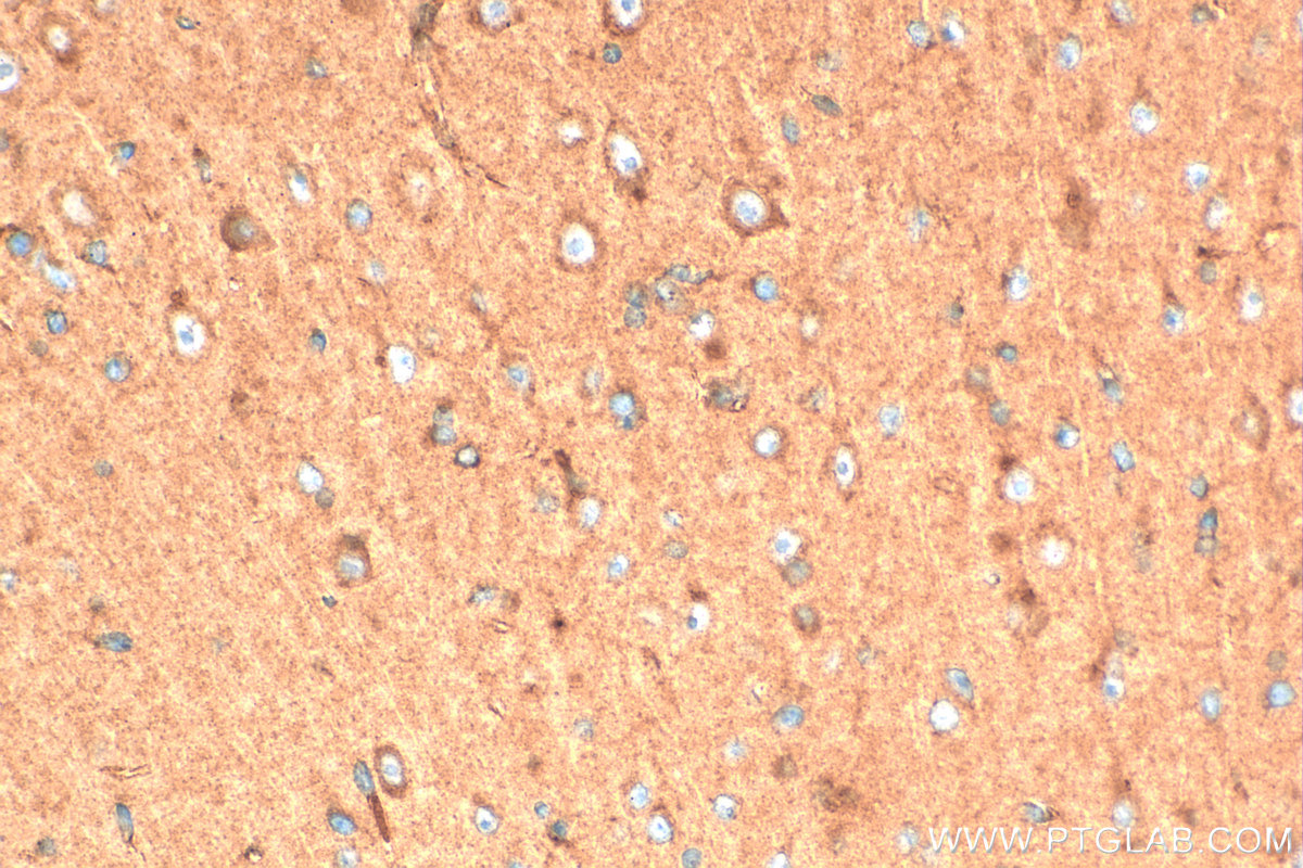 IHC staining of mouse brain using 33973-1-AP