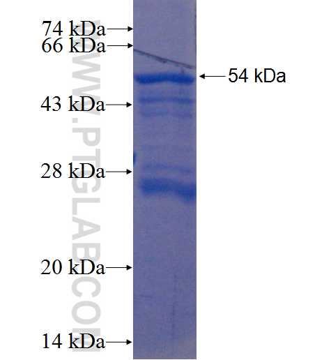 HICE1 fusion protein Ag22498 SDS-PAGE HICE1 fusion protein Ag22498 SDS-PAGE