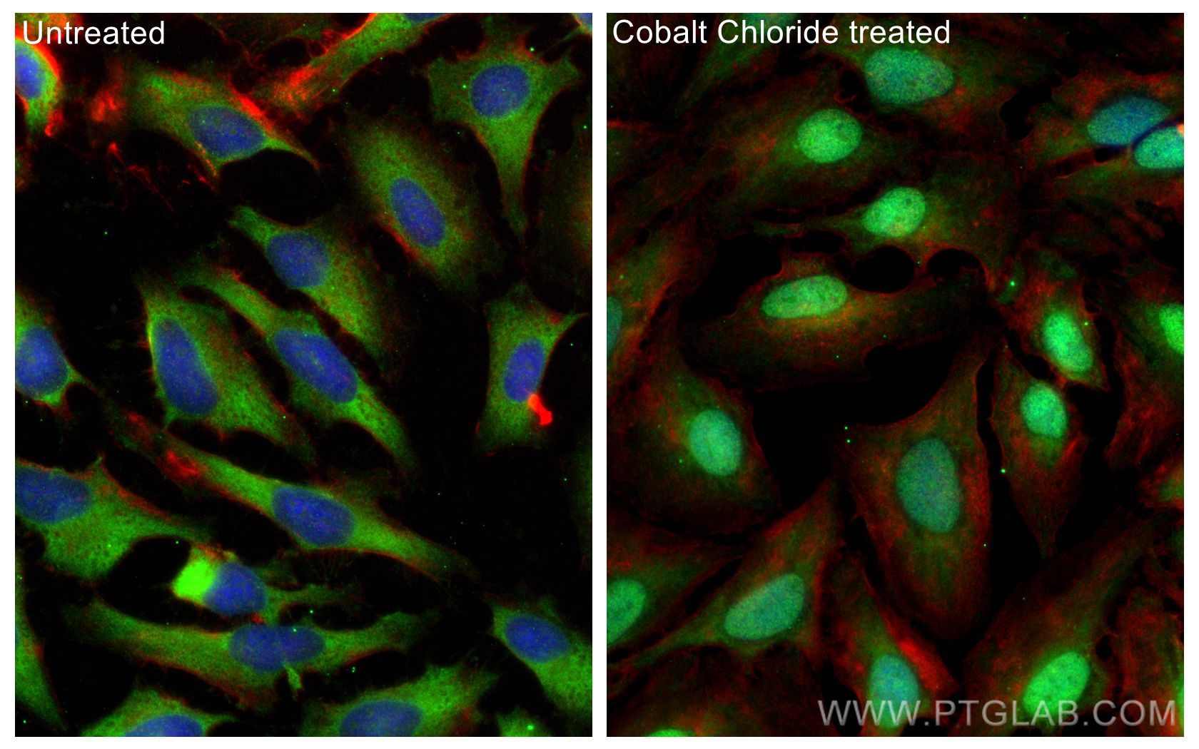 IF Staining of HeLa using 20960-1-AP