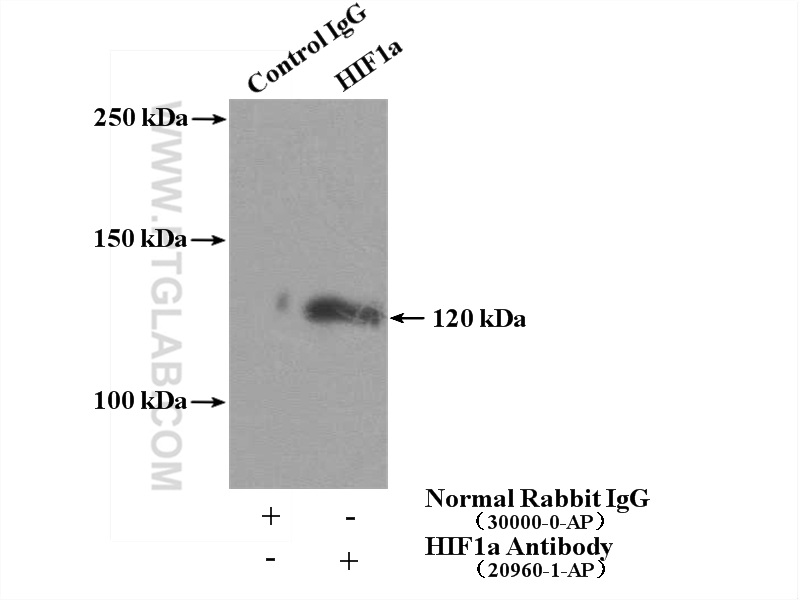 IP experiment of HeLa using 20960-1-AP