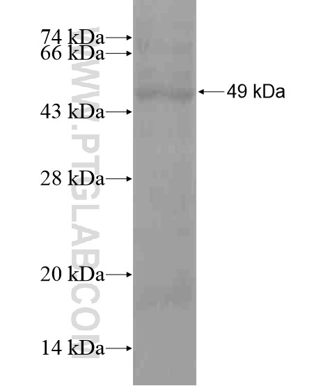 HIF1AN fusion protein Ag20959 SDS-PAGE HIF1AN fusion protein Ag20959 SDS-PAGE