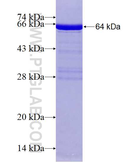HIF1AN fusion protein Ag0997 SDS-PAGE