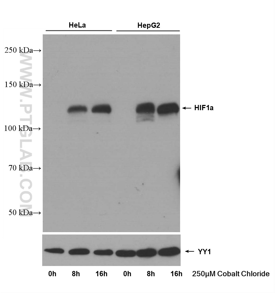 WB analysis of HeLa using 66730-1-Ig (same clone as 66730-1-PBS)