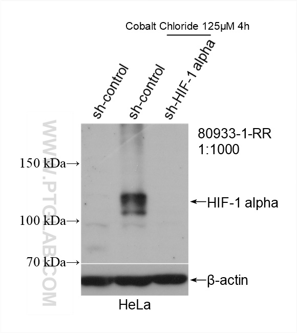 WB analysis of HeLa using 80933-1-RR (same clone as 80933-1-PBS)
