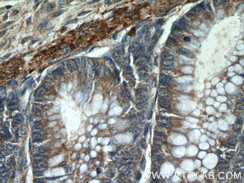 IHC staining of human colon using 25367-1-AP