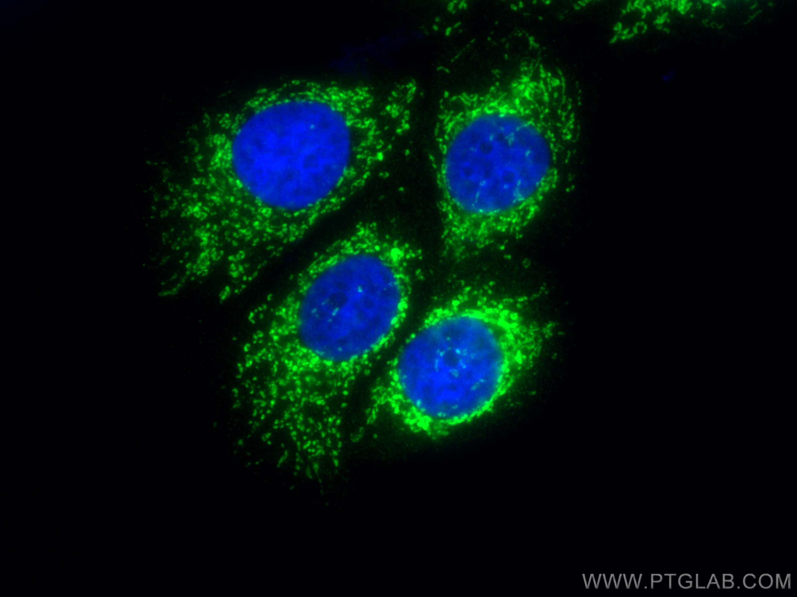 IF Staining of MCF-7 using 21415-1-AP