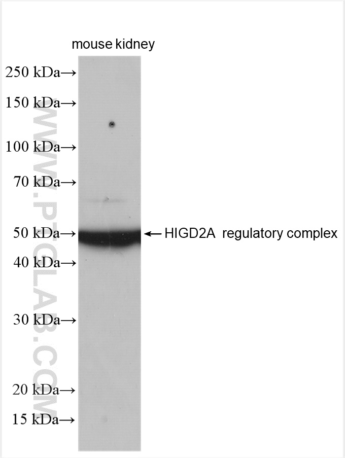 WB analysis of mouse kidney using 21415-1-AP