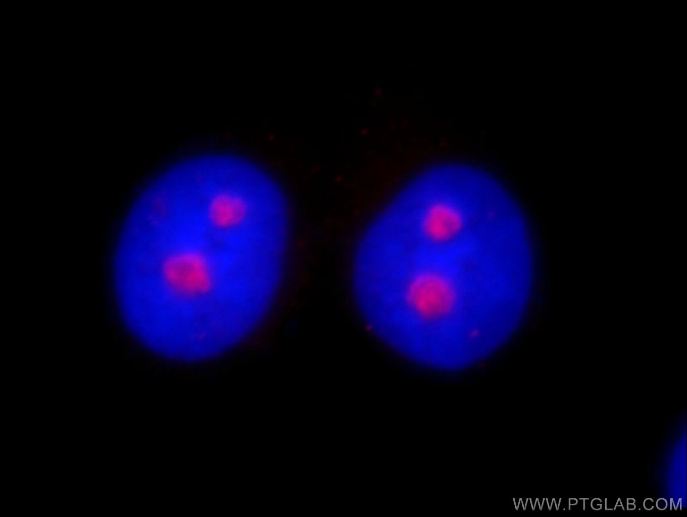 IF Staining of HeLa using 10066-2-AP (same clone as 10066-2-PBS)