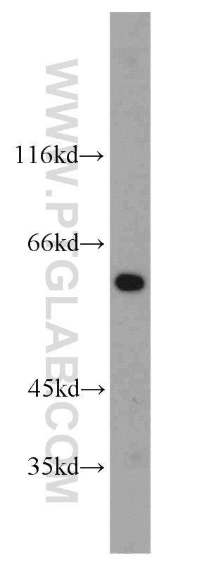 WB analysis of human liver using 10066-2-AP