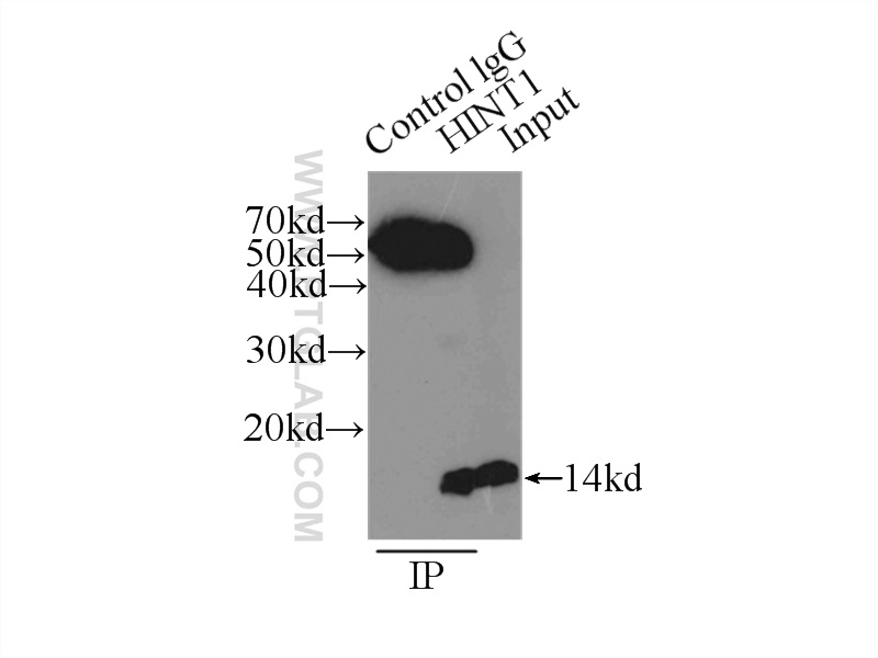 IP experiment of mouse brain using 10717-1-AP