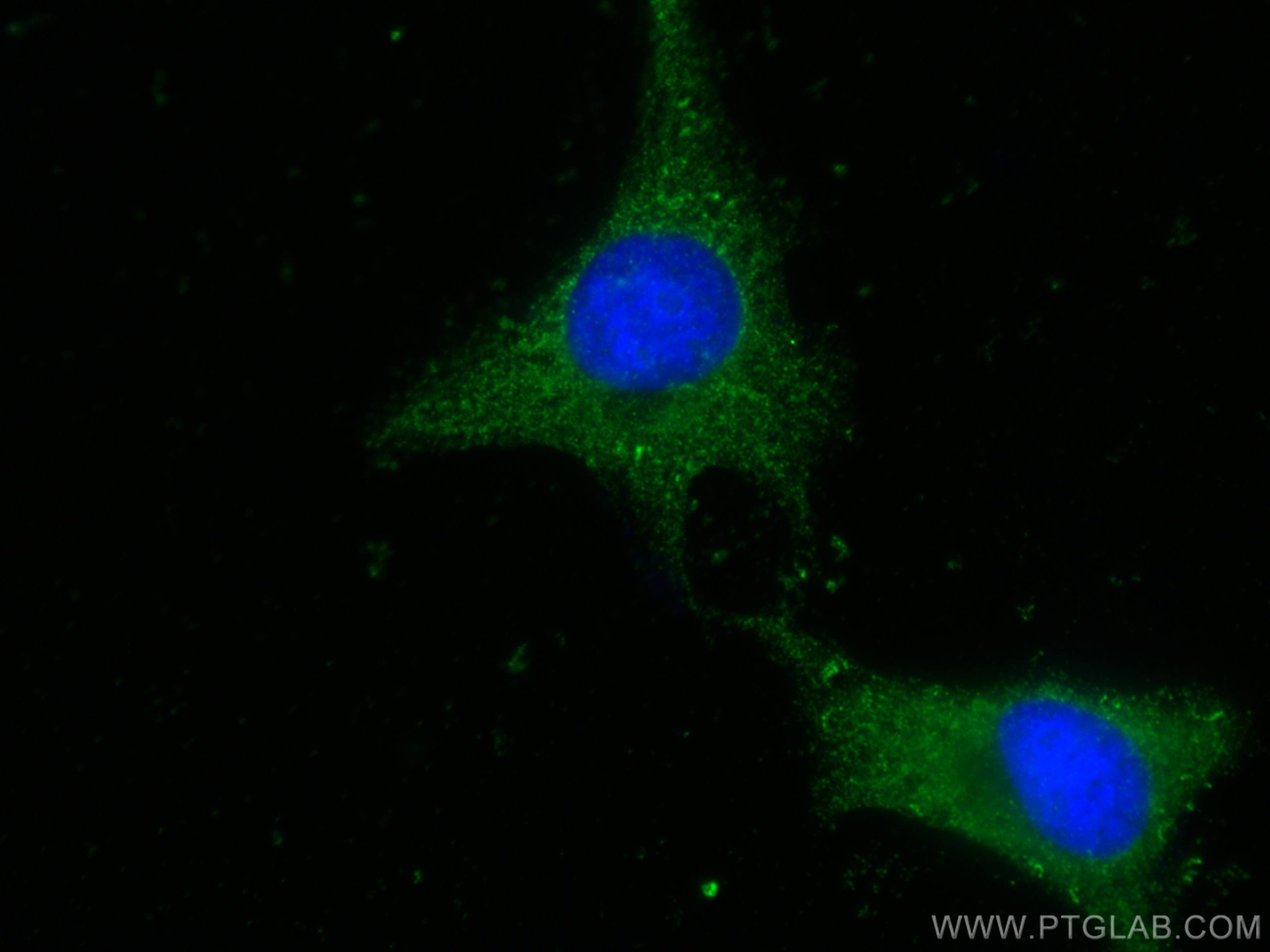 IF Staining of HeLa using 67583-1-Ig (same clone as 67583-1-PBS)