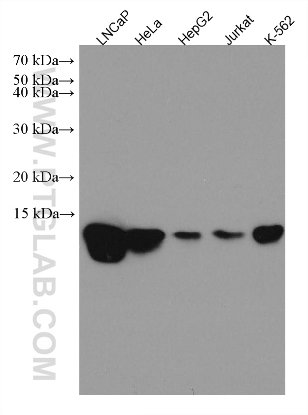 WB analysis using 67583-1-Ig