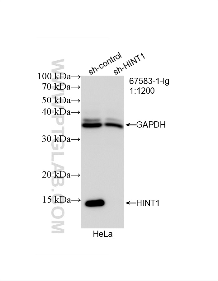 WB analysis of HeLa using 67583-1-Ig (same clone as 67583-1-PBS)