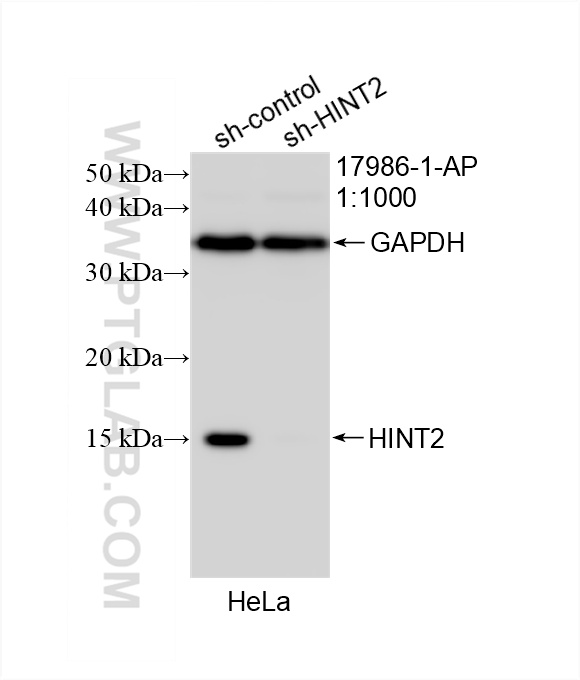 WB analysis of HeLa using 17986-1-AP
