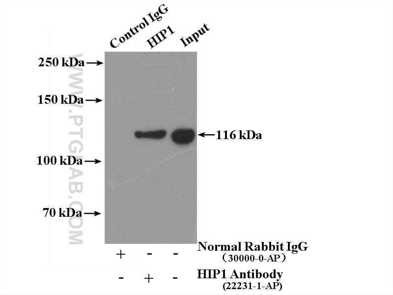 IP experiment of HeLa using 22231-1-AP