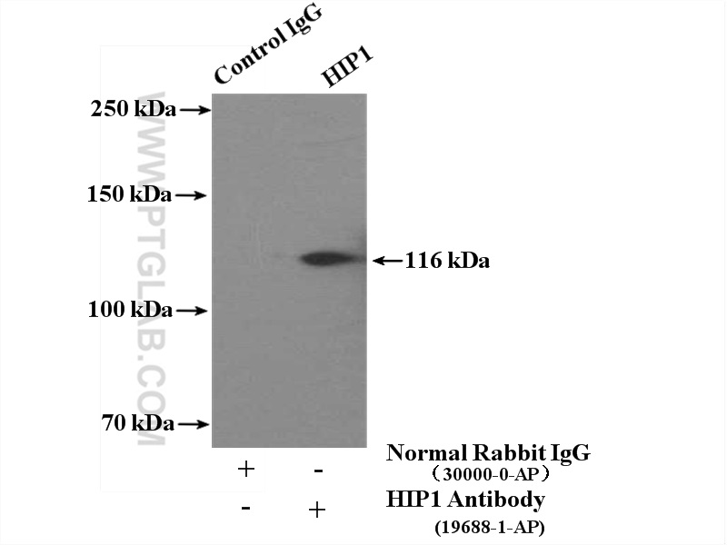 IP experiment of HEK-293 using 19688-1-AP