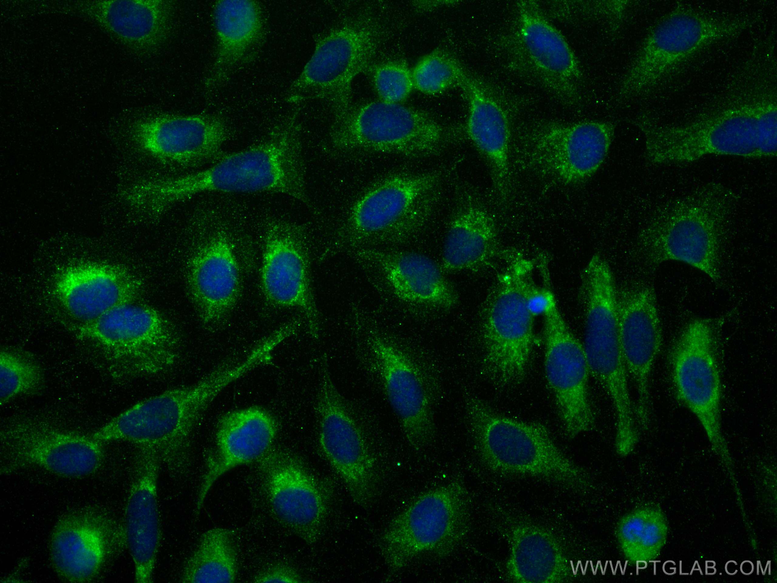 IF Staining of U2OS using 30022-1-AP (same clone as 30022-1-PBS)