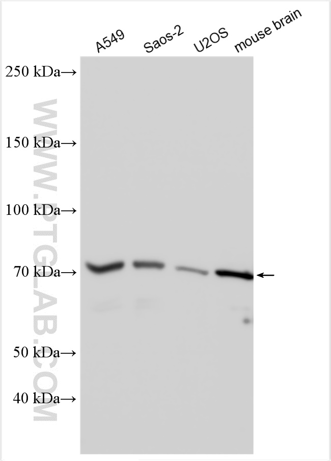 WB analysis using 30022-1-AP