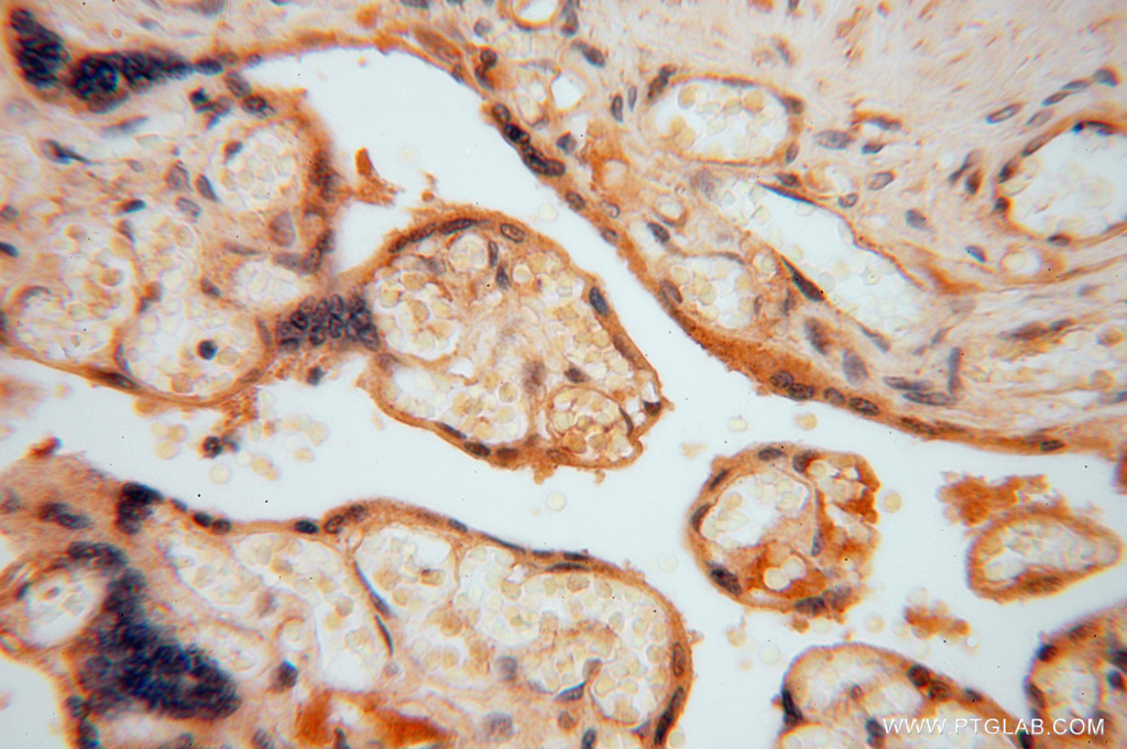 IHC staining of human placenta using 16814-1-AP