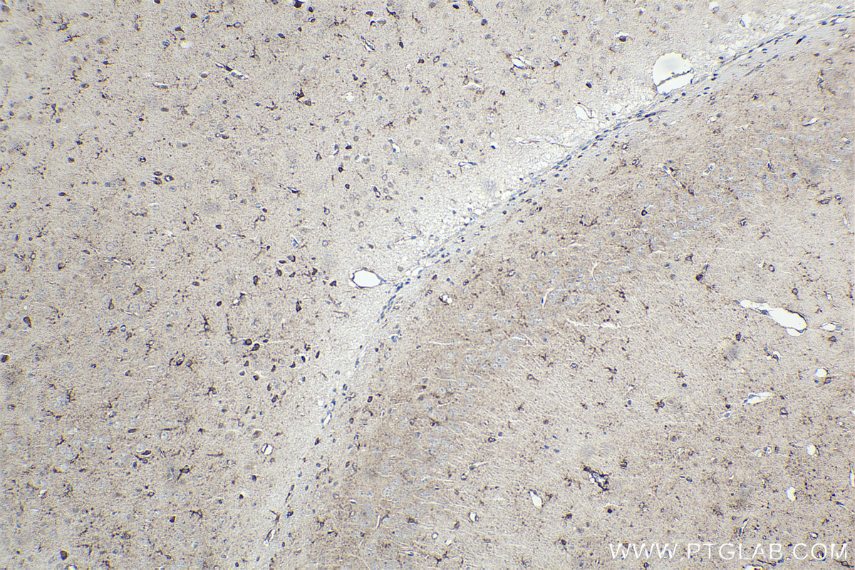 IHC staining of mouse brain using 55408-1-AP