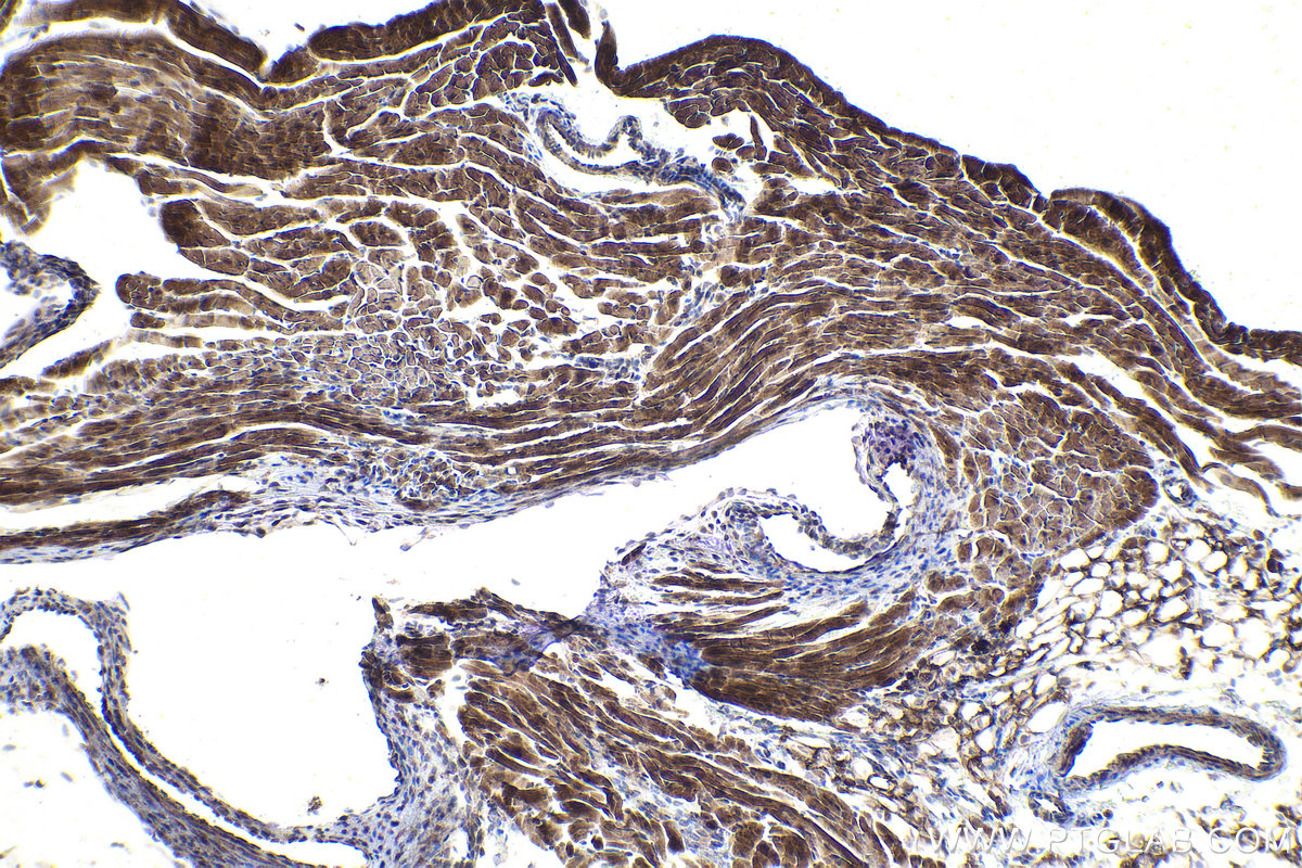 IHC staining of mouse heart using 55408-1-AP