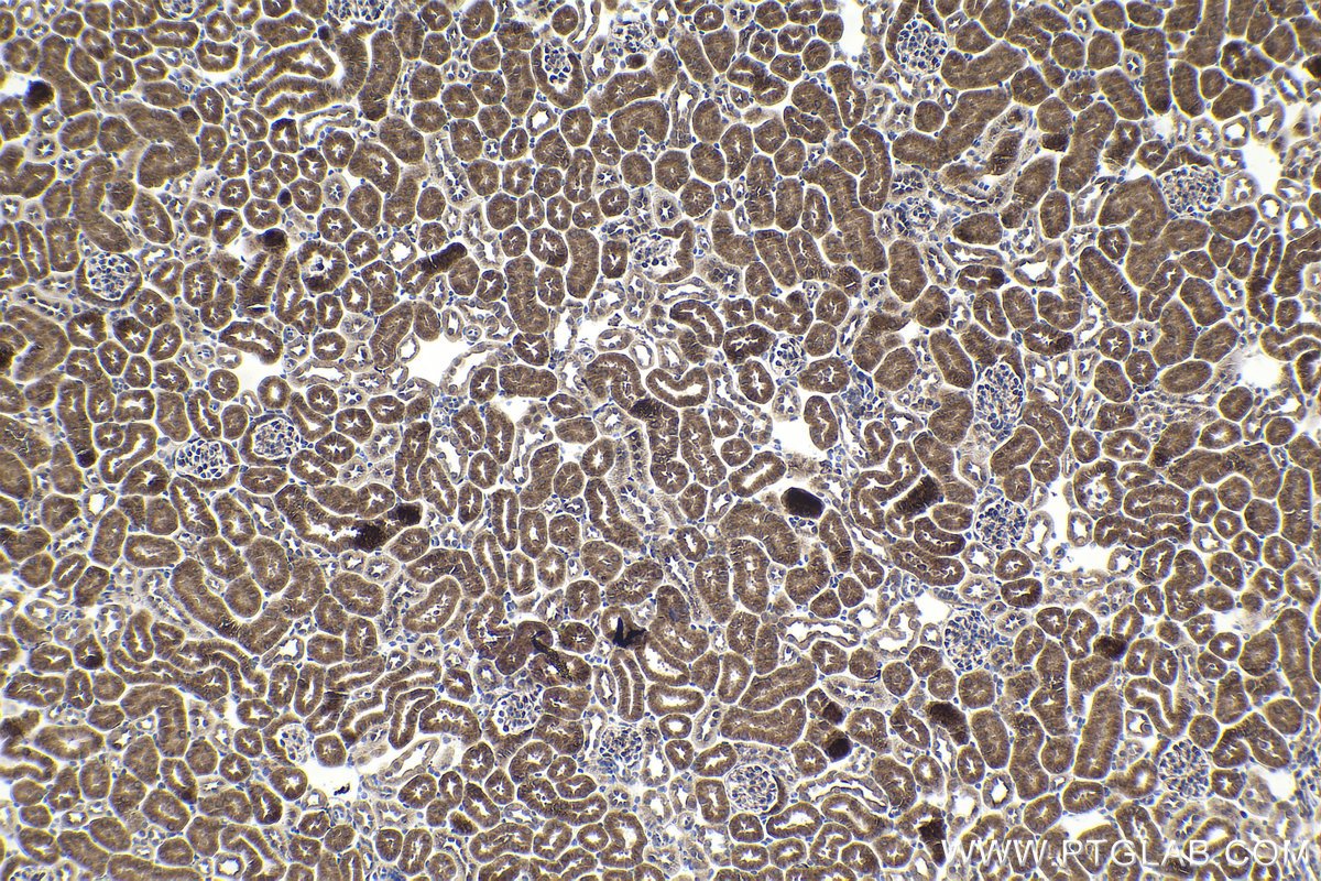 IHC staining of mouse kidney using 55408-1-AP