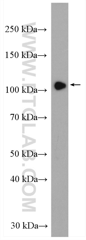 WB analysis of mouse kidney using 55408-1-AP