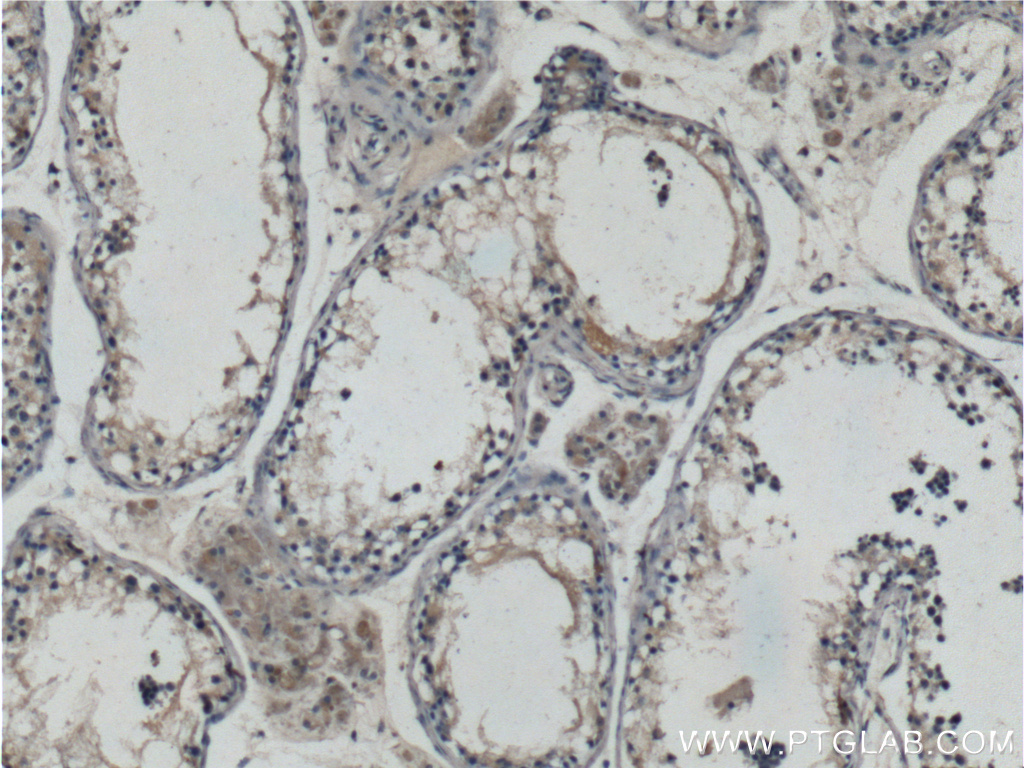 IHC staining of human testis using 25107-1-AP