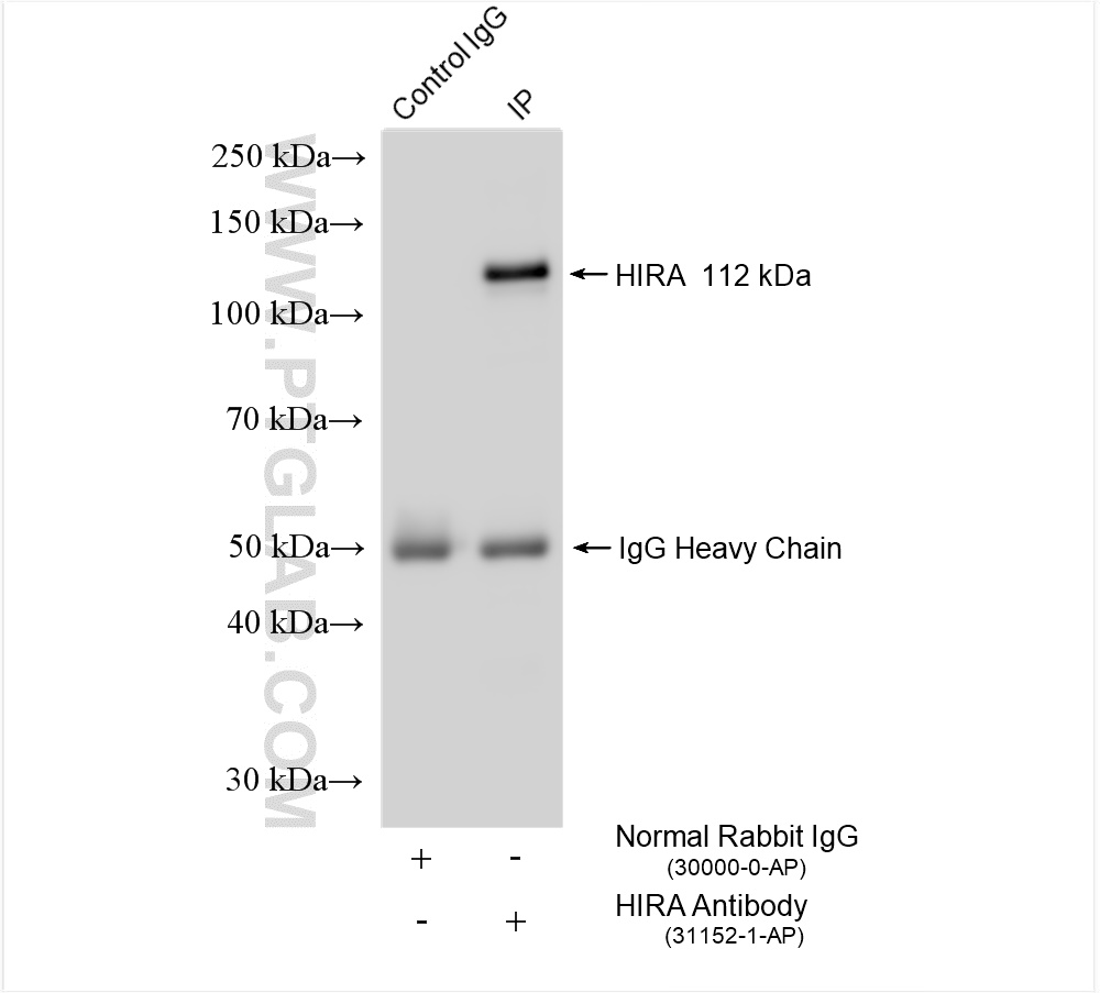 IP experiment of HepG2 using 31152-1-AP