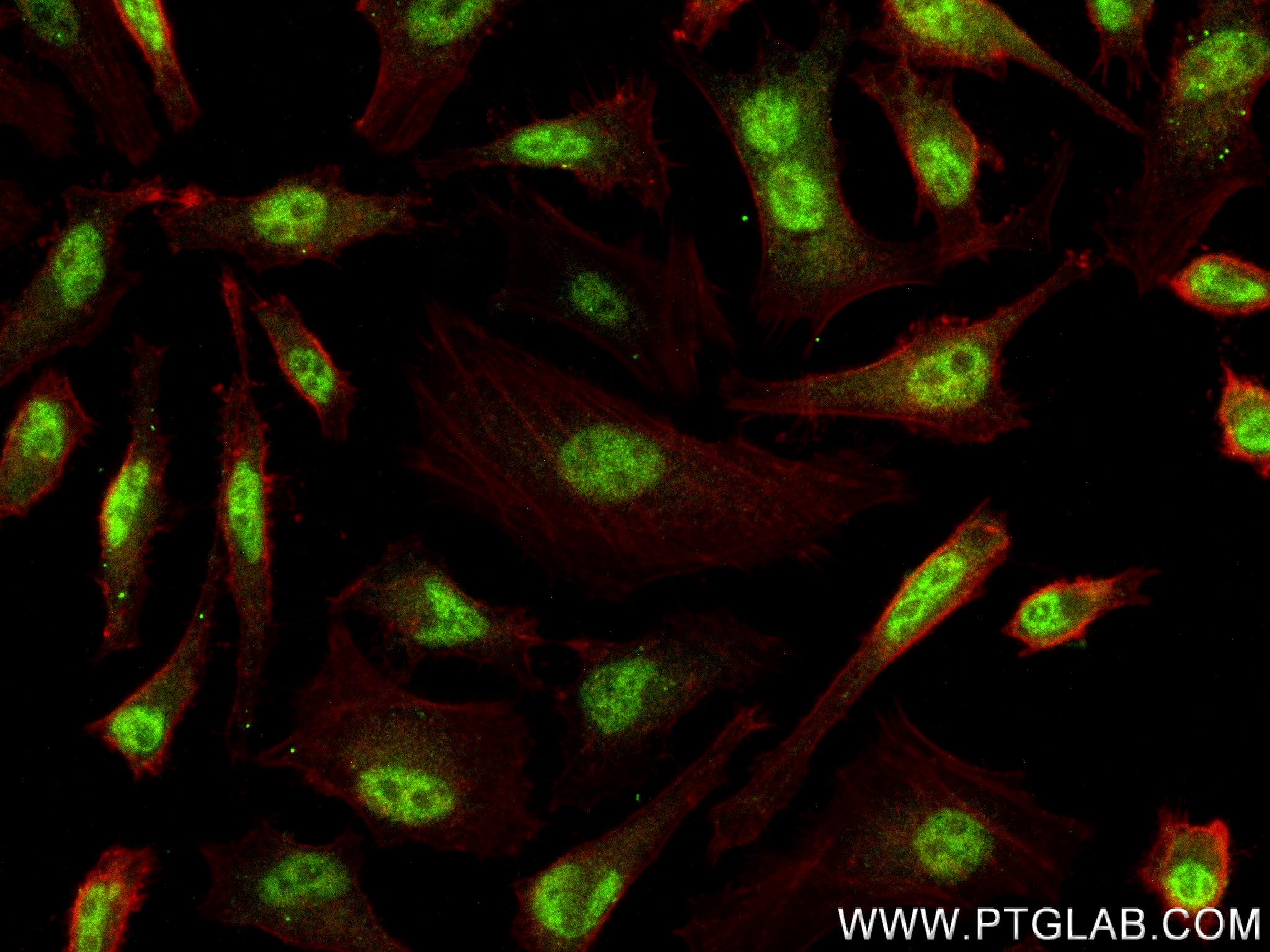 IF Staining of HeLa using 83194-5-RR
