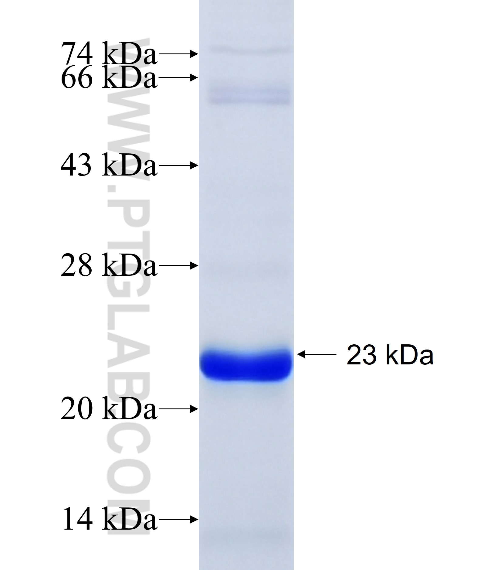 HIRA fusion protein Ag34457 SDS-PAGE HIRA fusion protein Ag34457 SDS-PAGE