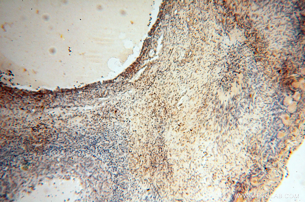 IHC staining of human ovary using 14992-1-AP