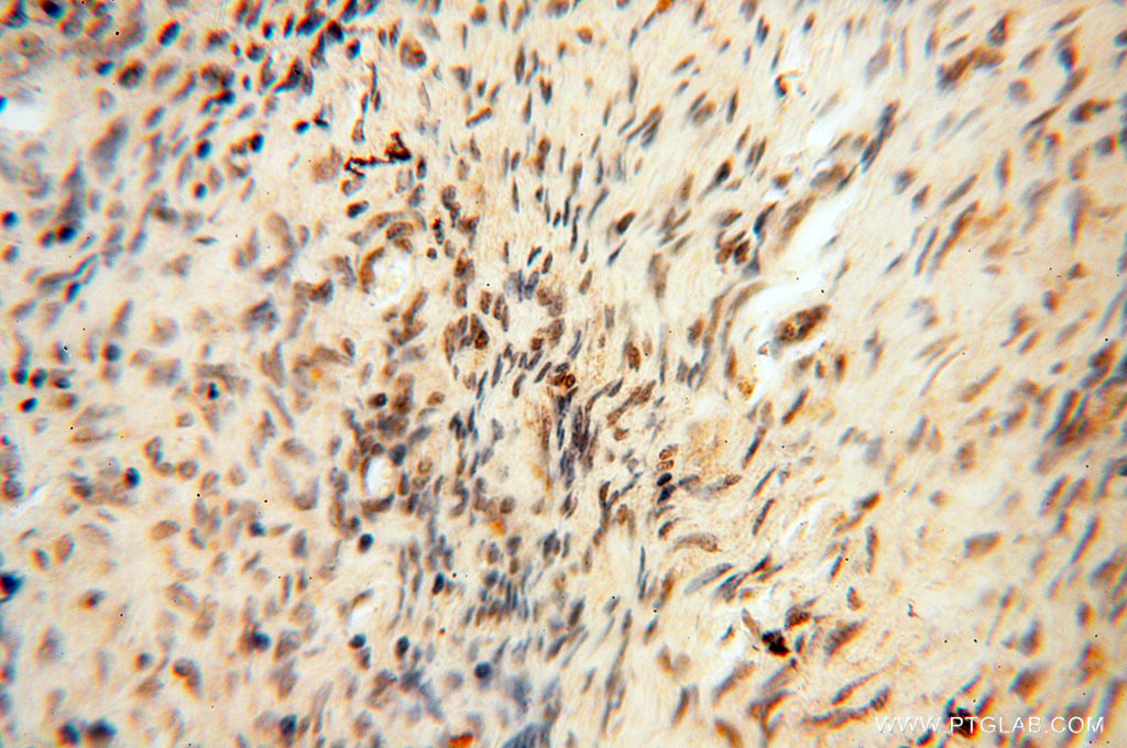 IHC staining of human ovary using 14992-1-AP